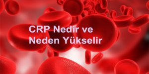 CRP Nedir ve Neden Yükselir